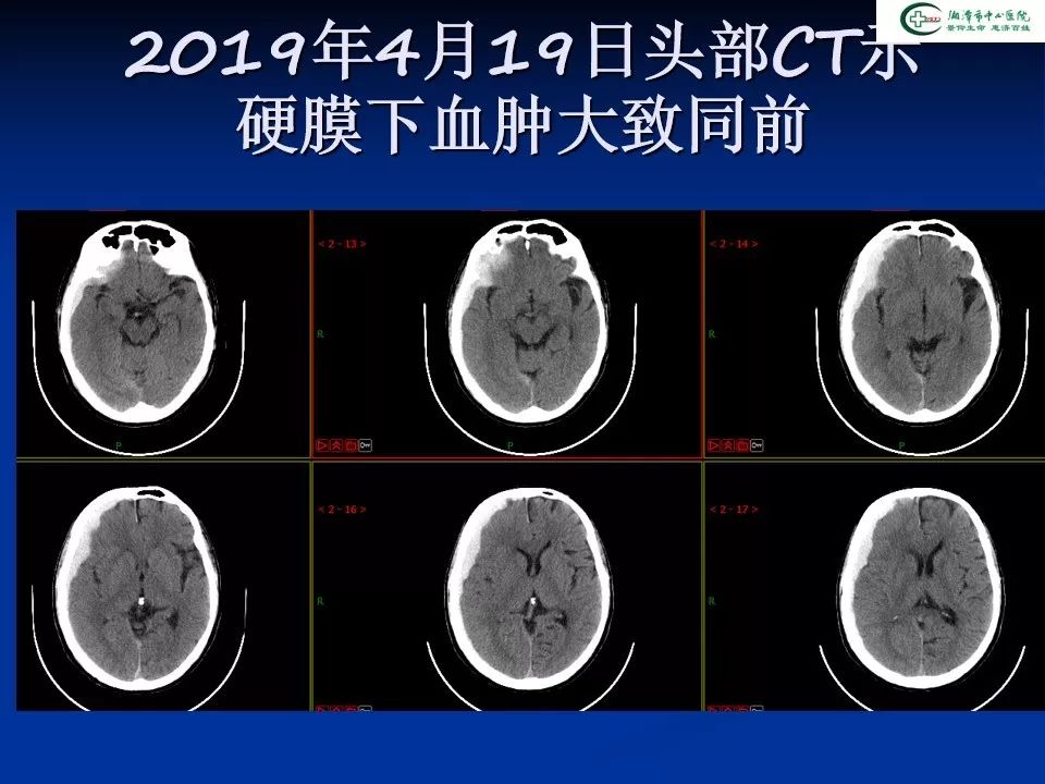 沧州新增1例的简单介绍-第3张图片