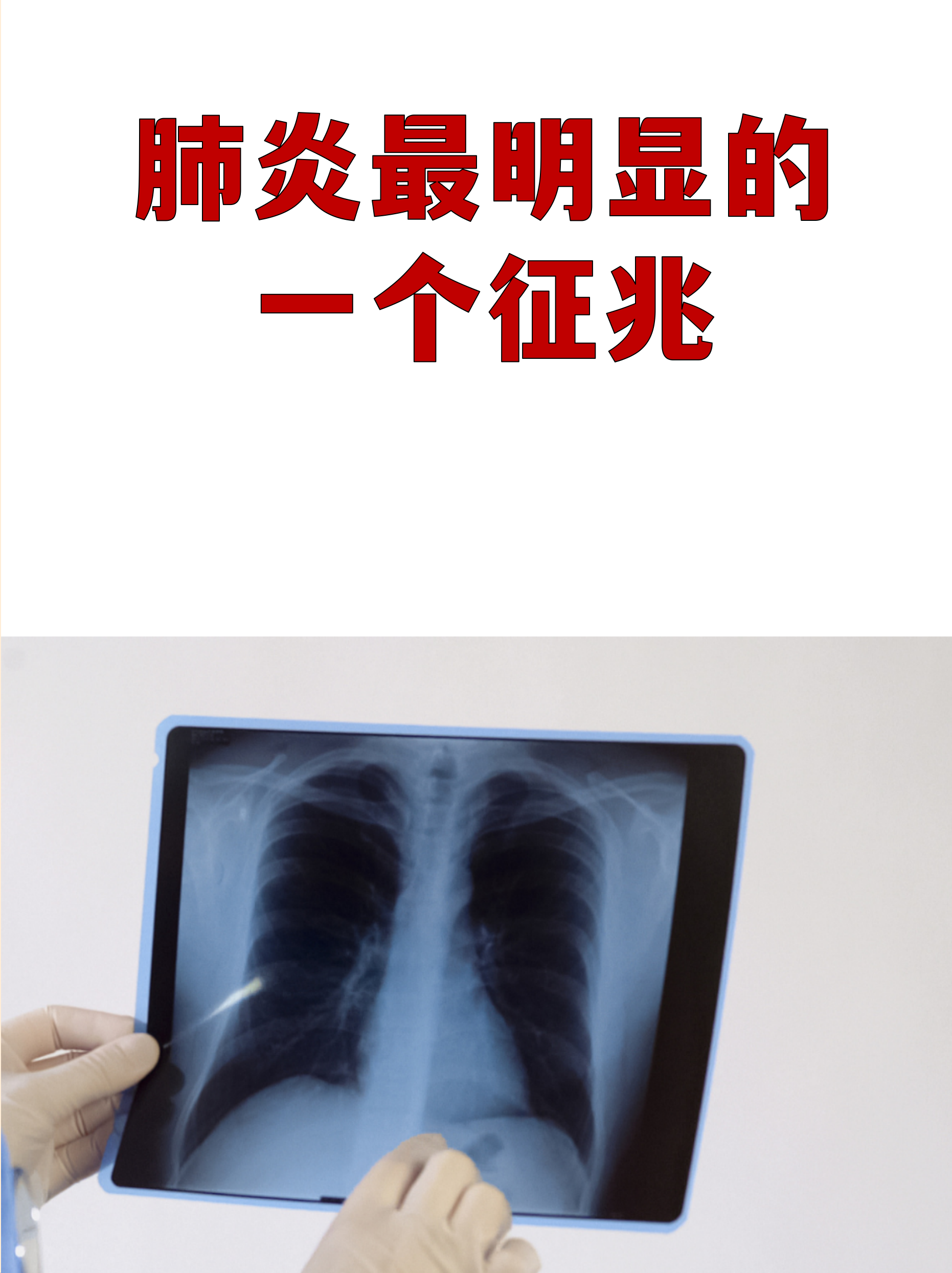 31省区市新增2例新冠肺炎.31省区市新增确诊3例-第2张图片