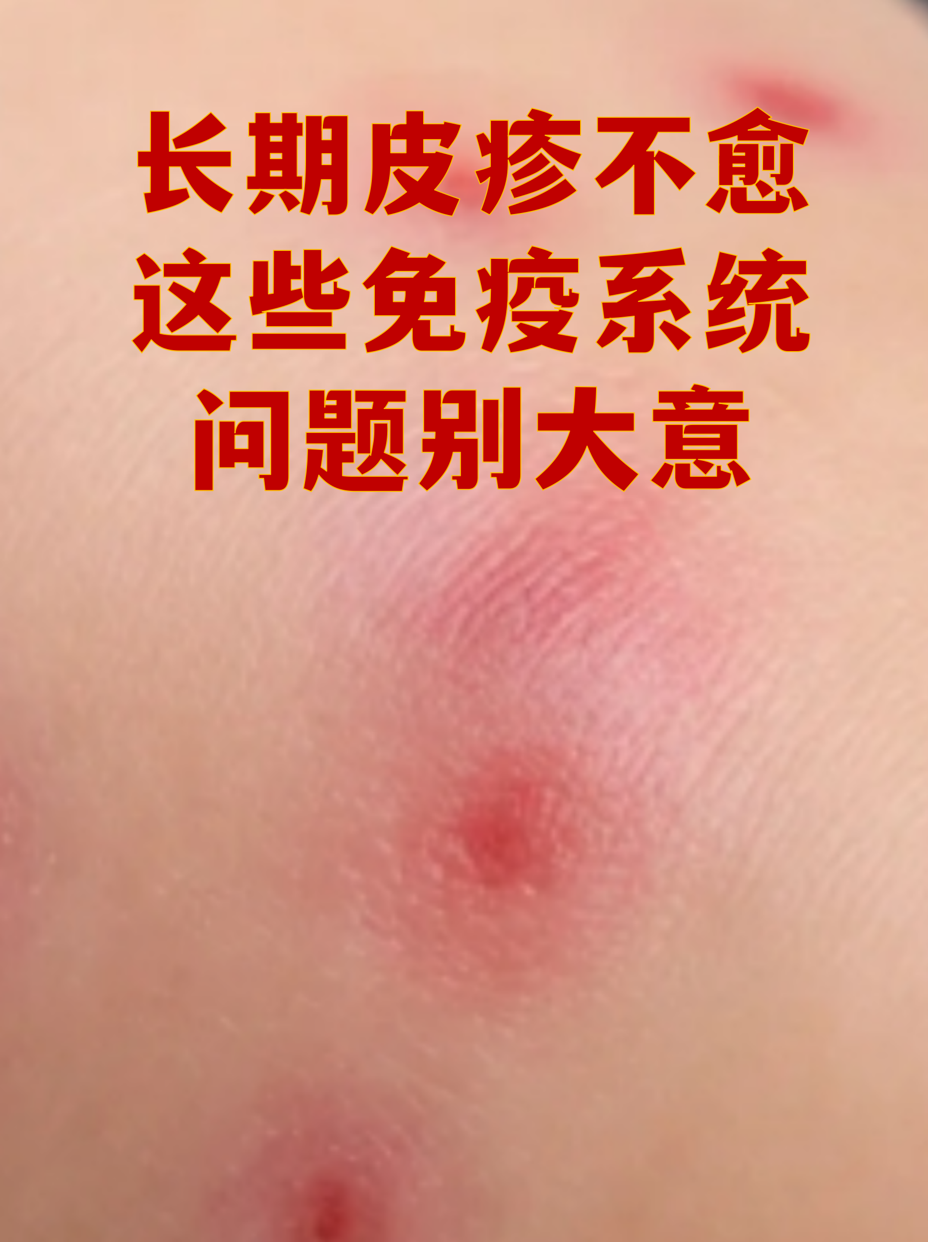 “上海社会面新增1例无症状” 上海一例无症状？-第1张图片